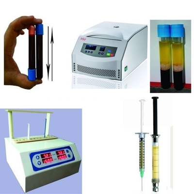 6/8x15ml Dispositivo di centrifugazione portatile PRP 0-4000rpm Per ospedali di chirurgia estetica