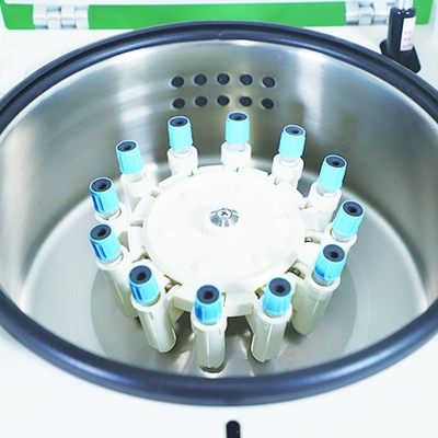Test del sangue rosso per la lavastoviglie multifunzionale a tavolo professionale